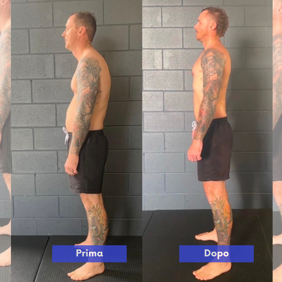 Correttore di postura istantaneo