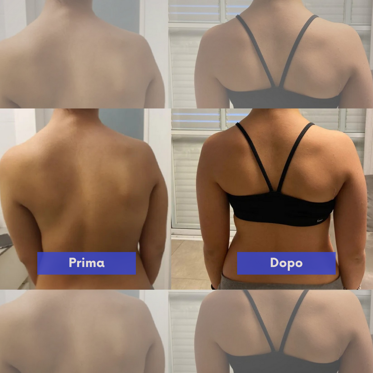 Correttore di postura istantaneo