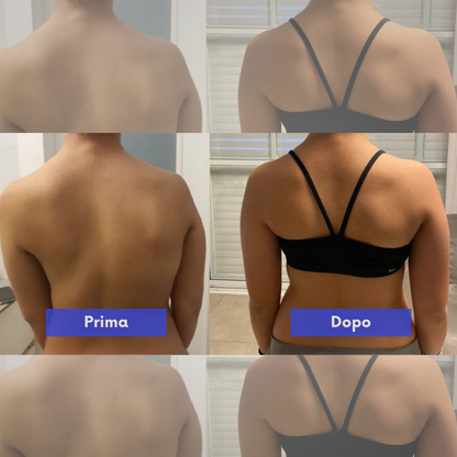 Correttore di postura istantaneo